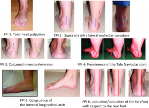 foot analysis pic 2